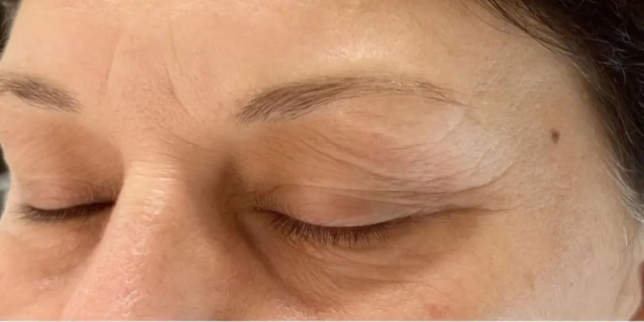 A client's natural brows before treatment, with mapping guides